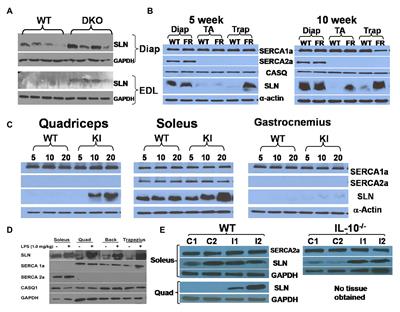Is Upregulation of Sarcolipin Beneficial or Detrimental to Muscle Function?